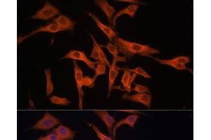 Immunofluorescence analysis of HeLa cells using LGMN Polyclonal Antibody at dilution of 1:100 (40x lens). (LGMN 抗体)