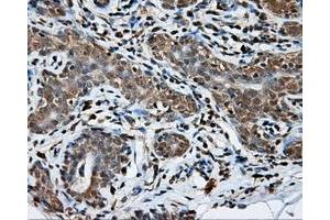 Immunohistochemical staining of paraffin-embedded breast tissue using anti-NPR3 mouse monoclonal antibody. (NPR3 抗体)
