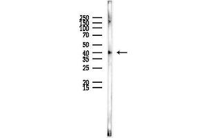 anti-Mitochondrial Ribosomal Protein S22 (MRPS22) (C-Term) antibody