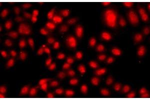 Immunofluorescence analysis of A549 cells using TEAD3 Polyclonal Antibody (TEAD3 抗体)