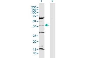 Western Blot analysis of CDK6 expression in transfected 293T cell line by CDK6 MaxPab polyclonal antibody. (CDK6 抗体  (AA 1-326))