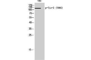 Western Blotting (WB) image for anti-TEK Tyrosine Kinase, Endothelial (TEK) (pTyr992) antibody (ABIN3182332) (TEK 抗体  (pTyr992))