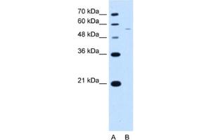 Western Blotting (WB) image for anti-arginine/serine-Rich Coiled-Coil 2 (RSRC2) antibody (ABIN2463413) (RSRC2 抗体)