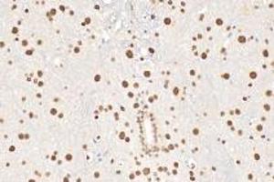 Immunohistochemistry (Paraffin-embedded Sections) (IHC (p)) image for anti-Ring Finger Protein 1 (RING1) antibody (ABIN7075467)