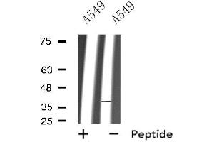 Western blot analysis of extracts from A549 cells, using RHO antibody. (Rho-related GTP-binding protein 抗体)