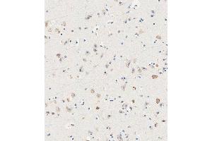 Immunohistochemistry (Paraffin-embedded Sections) (IHC (p)) image for anti-Solute Carrier Family 14 (Urea Transporter, Kidney) Member 2 (SLC14A2) (AA 42-76) antibody (ABIN6243332)