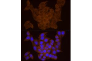 Immunofluorescence analysis of HeLa cells using DTYMK Rabbit mAb (ABIN7266735) at dilution of 1:25 (40x lens). (DTYMK 抗体)