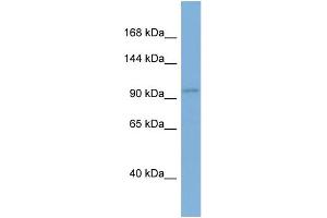 WB Suggested Anti-EIF2C1 Antibody Titration: 0. (AGO1 抗体  (N-Term))