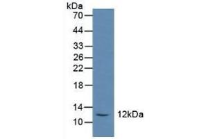 Detection of SST in Rat Serum using Polyclonal Antibody to Somatostatin (SST) (Somatostatin 抗体  (AA 27-116))