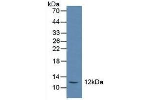 Detection of SST in Rat Serum using Polyclonal Antibody to Somatostatin (SST) (Somatostatin 抗体  (AA 27-116))