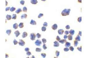 Immunocytochemistry of CTRP7 in 293 cells with AP30260PU-N CTRP7 antibody at 10 μg/ml. (CTRP7 抗体)