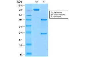 SDS-PAGE analysis of purified, BSA-free recombinant TRAcP antibody (clone rACP5/1070) as confirmation of integrity and purity. (ACP5 抗体)