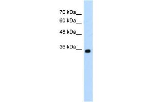 Western Blotting (WB) image for anti-Zinc Finger, MYND-Type Containing 11 (ZMYND11) (N-Term) antibody (ABIN2775964)