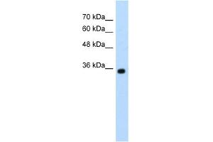 WB Suggested Anti-ZMYND11 Antibody Titration:  1. (ZMYND11 抗体  (N-Term))