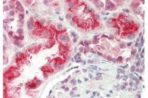 Immunohistochemistry (IHC) image for anti-Solute Carrier Family 7 (Amino Acid Transporter Light Chain, Y+L System), Member 7 (Slc7a7) (Middle Region) antibody (ABIN2781597)