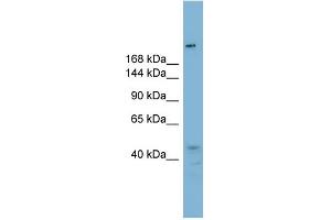 WB Suggested Anti-RBBP6 Antibody Titration:  0. (RBBP6 抗体  (N-Term))