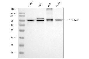 Western blot analysis of Golgin 97/GOLGA1 using anti-Golgin 97/GOLGA1 antibody (ABIN7599538).