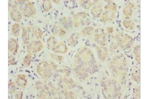 Immunohistochemistry of paraffin-embedded human salivary gland tissue using ABIN7173912 at dilution of 1:100 (TPD52L1 抗体  (AA 1-144))