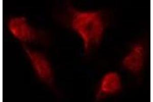 ABIN6275989 staining HUVEC by IF/ICC. (FSHR 抗体  (Internal Region))