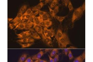 Immunofluorescence analysis of C6 cells using RPL17 Polyclonal Antibody at dilution of 1:100. (RPL17 抗体)