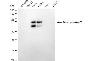 Western blotting analysis using tumor protein p73 antibody (ABIN7800694).