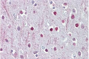 Brain, cortex (Cnpase 抗体  (Middle Region))