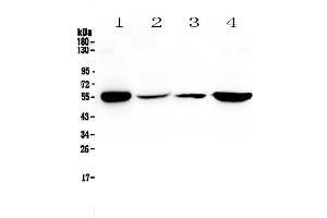 Western blot analysis of Glutathione Reductase using anti-Glutathione Reductase antibody . (Glutathione Reductase 抗体  (AA 256-522))