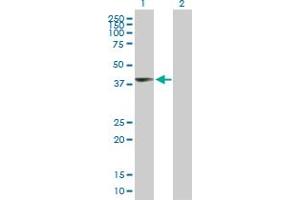 Western Blot analysis of UPP2 expression in transfected 293T cell line by UPP2 MaxPab polyclonal antibody. (UPP2 抗体  (AA 1-317))