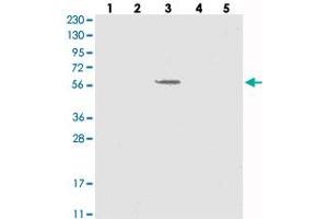 Western blot analysis of Lane 1: RT-4, Lane 2: U-251 MG, Lane 3: Human Plasma, Lane 4: Liver, Lane 5: Tonsil with SLC43A3 polyclonal antibody . (SLC43A3 抗体)