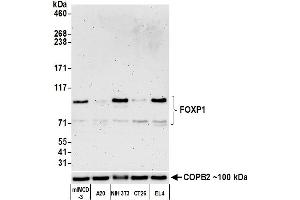 Western Blotting (WB) image for anti-Forkhead Box P1 (FOXP1) (AA 627-677) antibody (ABIN7454010) (Recombinant FOXP1 抗体  (AA 627-677))