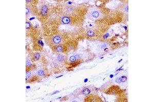 Immunohistochemical analysis of HADH staining in rat liver  formalin fixed paraffin embedded tissue section. (HADH 抗体)