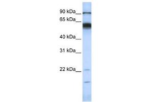 MMP16 antibody used at 1 ug/ml to detect target protein. (MMP16 抗体)