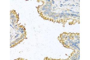 Immunohistochemistry of paraffin-embedded Human prostate using RNASE13 Polyclonal Antibody at dilution of 1:100 (40x lens). (RNASE13 抗体)