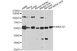 Western blot analysis of extracts of various cell lines, using HMGCS1 antibody. (HMGCS1 抗体  (AA 241-520))