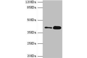 Western blot All lanes: GDAP1 antibody at 4. (GDAP1 抗体  (AA 1-225))