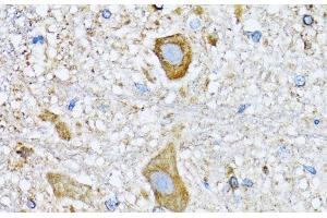 Immunohistochemistry of paraffin-embedded Mouse spinal cord using HDAC5 Polyclonal Antibody at dilution of 1:100 (40x lens). (HDAC5 抗体)