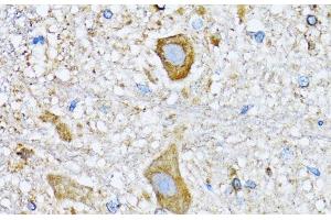 Immunohistochemistry of paraffin-embedded Mouse spinal cord using HDAC5 Polyclonal Antibody at dilution of 1:100 (40x lens).