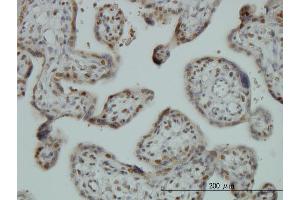 Immunoperoxidase of monoclonal antibody to FUBP1 on formalin-fixed paraffin-embedded human placenta. (FUBP1 抗体  (AA 27-136))