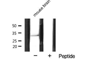 estern blot analysis of Cyclin D1 expression in mouse brain tissue lysates,The lane on the right is treated with the antigen-specific peptide. (Cyclin D1 抗体  (C-Term))