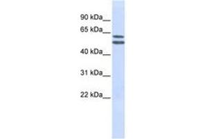 Image no. 1 for anti-Phosphatidylinositol Glycan Anchor Biosynthesis, Class Q (PIGQ) (AA 144-193) antibody (ABIN6740970) (PIGQ 抗体  (AA 144-193))