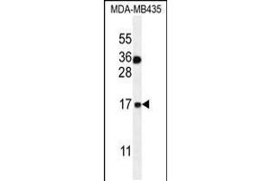 Western blot analysis in MDA-MB435 cell line lysates (35ug/lane). (S100A1 抗体  (C-Term))