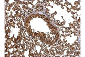 IHC-P Image EML1 antibody [C3], C-term detects EML1 protein at cytosol on mouse lung by immunohistochemical analysis.