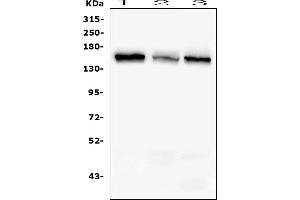 Western blot analysis of RAB3GAP2 using anti-RAB3GAP2 antibody (ABIN6719633). (RAB3GAP2 抗体  (AA 1-115))