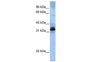 SFRS2B antibody used at 1 ug/ml to detect target protein. (SFRS2B 抗体  (Middle Region))