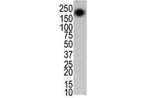 The LRRK2 antibody used in western blot to detect LRRK2/PARK8 in mouse brain cell lysate (LRRK2 抗体  (C-Term))