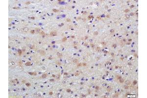 Formalin-fixed and paraffin embedded rat brain labeled with Anti-Phospho-Dab1 (Tyr198)Polyclonal Antibody, Unconjugated  at 1:200 followed by conjugation to the secondary antibody and DAB staining (DAB1 抗体  (pTyr198))