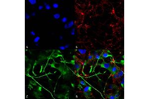 Immunocytochemistry/Immunofluorescence analysis using Mouse Anti-VAChT Monoclonal Antibody, Clone S6-38 (ABIN2485328). (SLC18A3 抗体  (AA 521-532) (FITC))