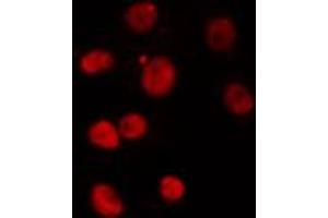 ABIN6274301 staining Hela cells by IF/ICC. (PITX1 抗体  (Internal Region))