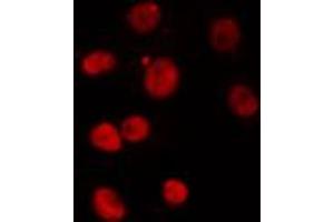 ABIN6274301 staining Hela cells by IF/ICC.