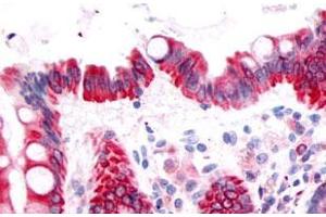 Immunohistochemical (Formalin/PFA-fixed paraffin-embedded sections) staining in human colon, epithelium with PTGDR polyclonal antibody . (PTGDR 抗体  (3rd Extracellular Domain))